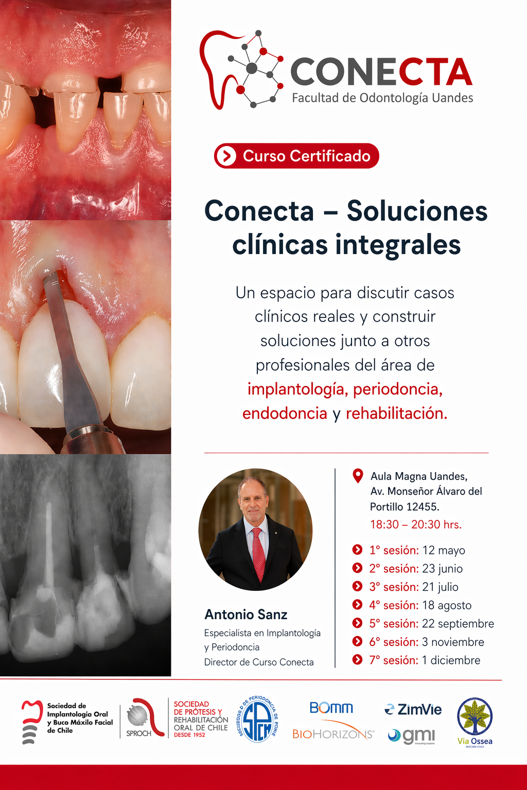 CONECTA Chile May26