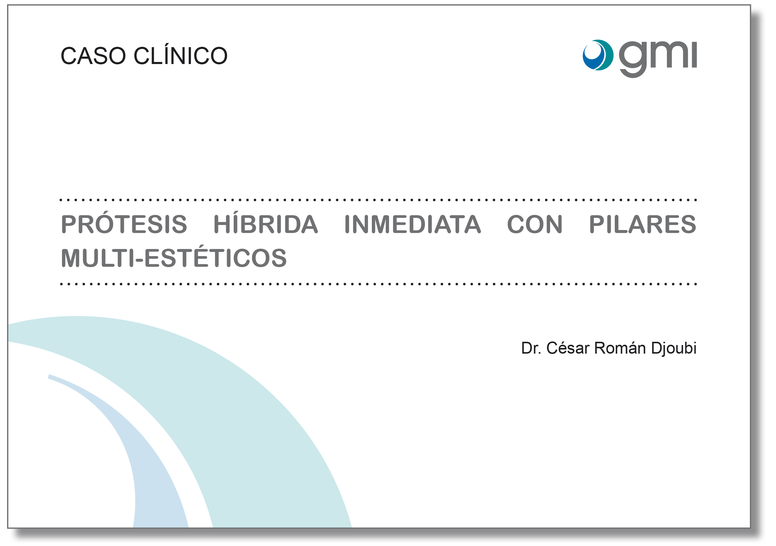 prótesis híbrida inmediata con pilares multi-estéticos