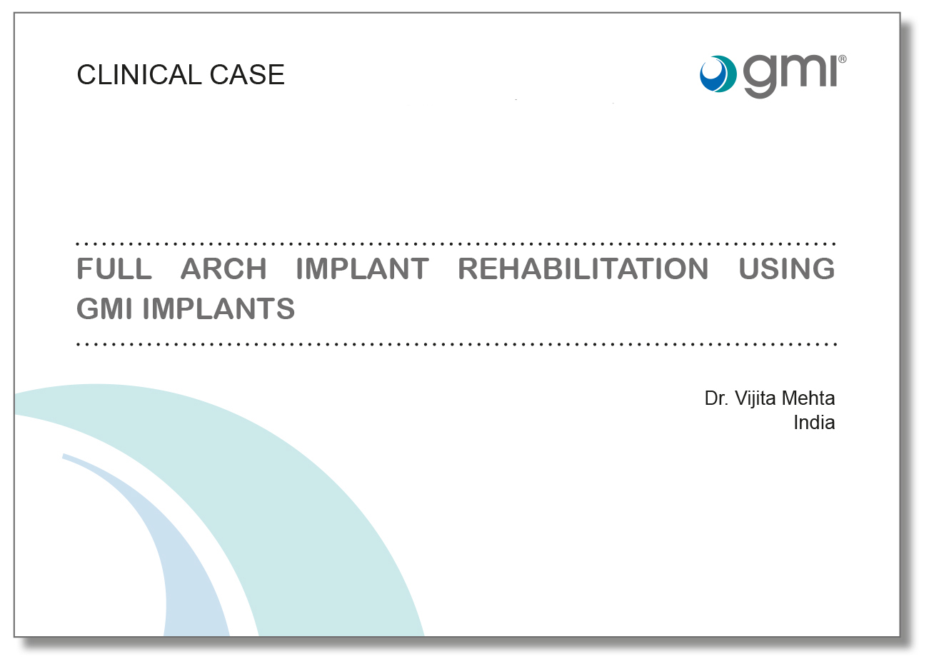 Full arch implant rehabilitation using gmi implants