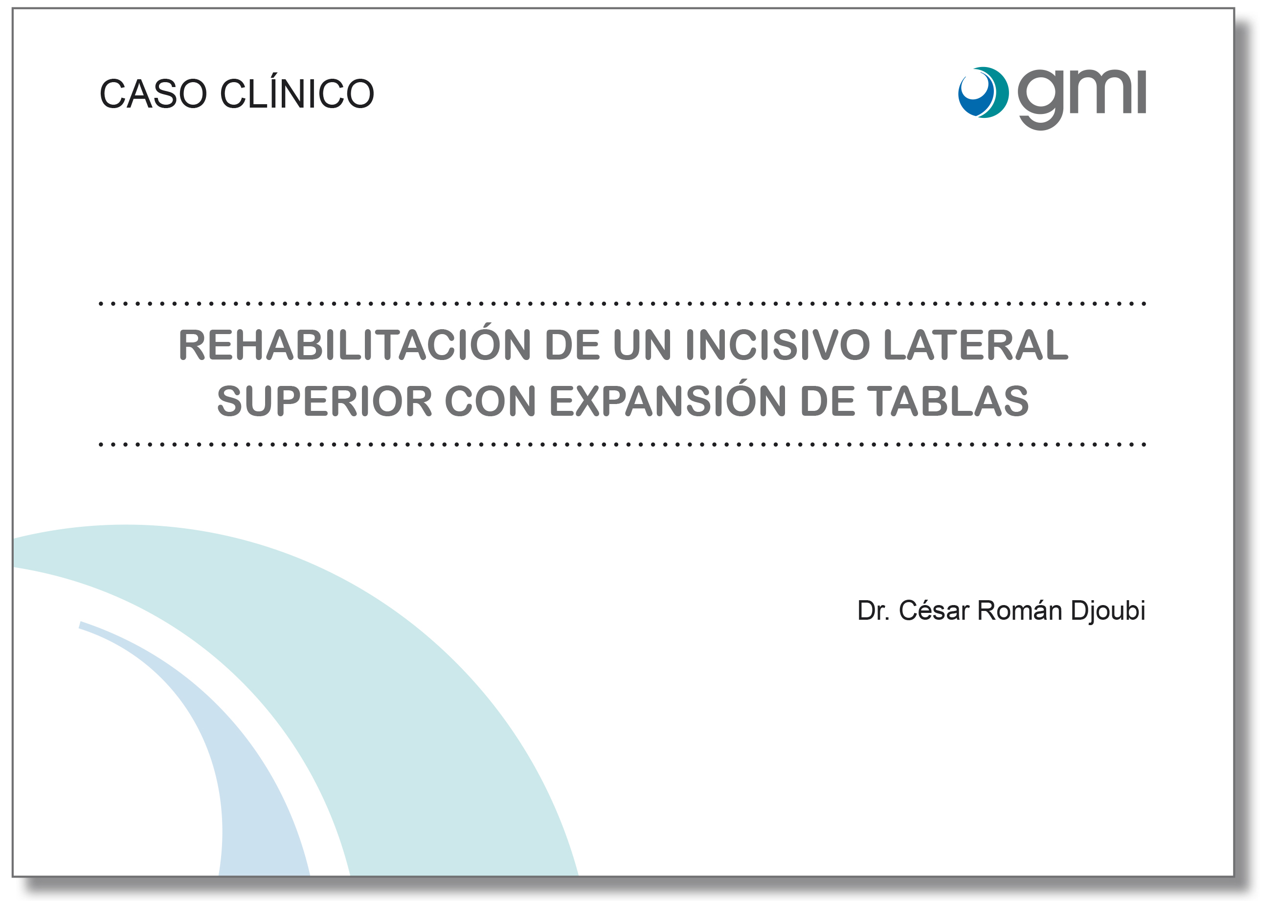 rehabilitación de un incisivo lateral superior con expansión de tablas