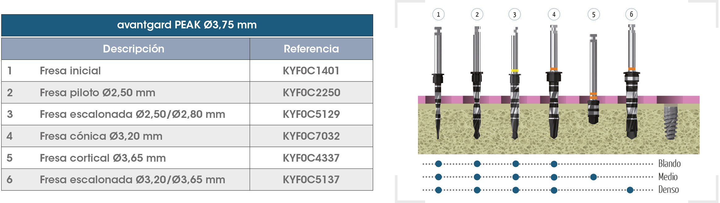 Secuencia Avantgard PEAK 375 ES